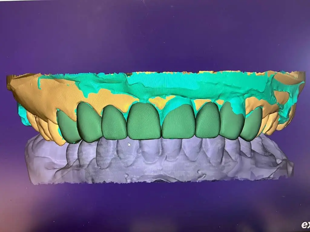 Nova Premier Dental