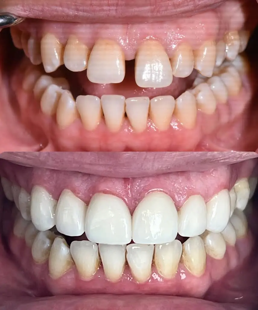 American Family Dental Care - Falls Church