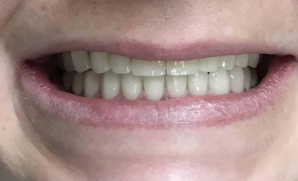 Simaya Prosthodontics