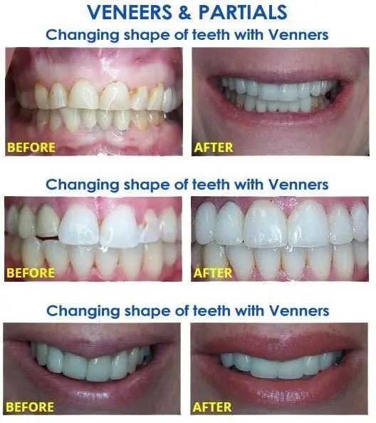Simaya Prosthodontics