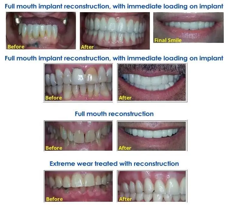 Simaya Prosthodontics
