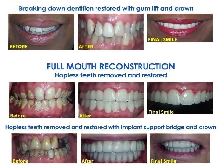 Simaya Prosthodontics