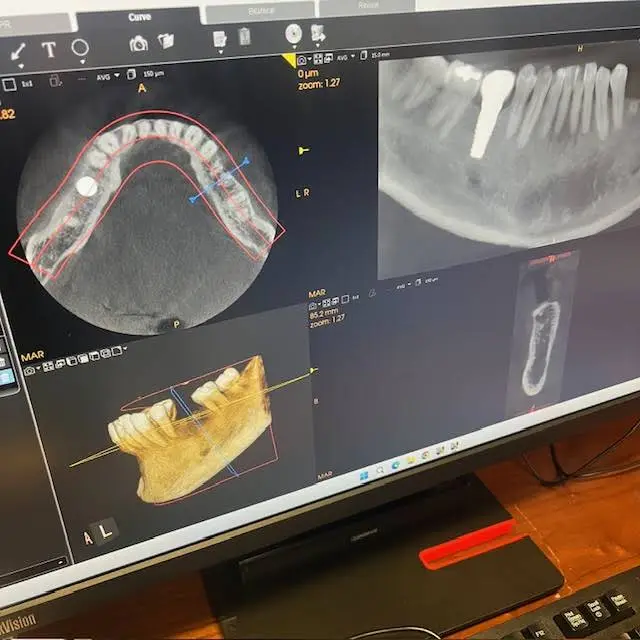 Miller Dental
