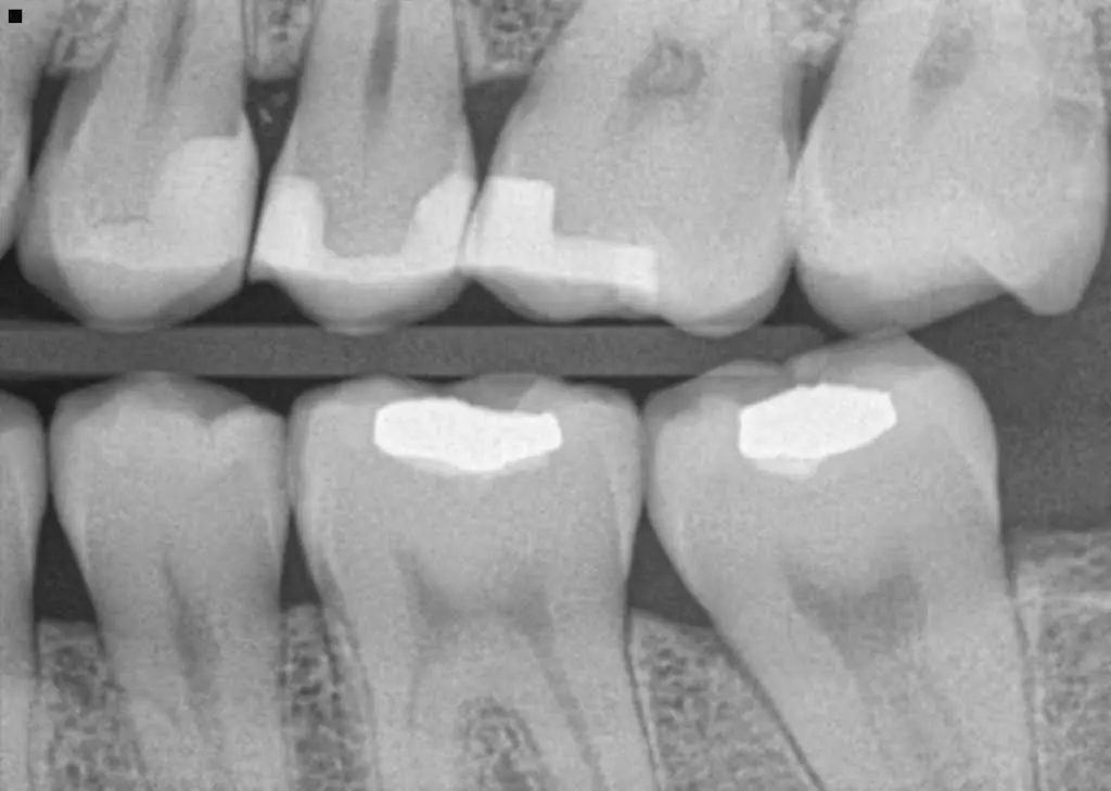 My Smiles Dental Center