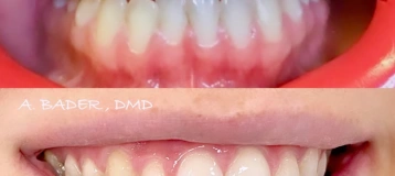 Allure Dental Chicago