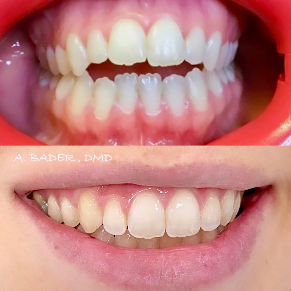 Allure Dental Chicago