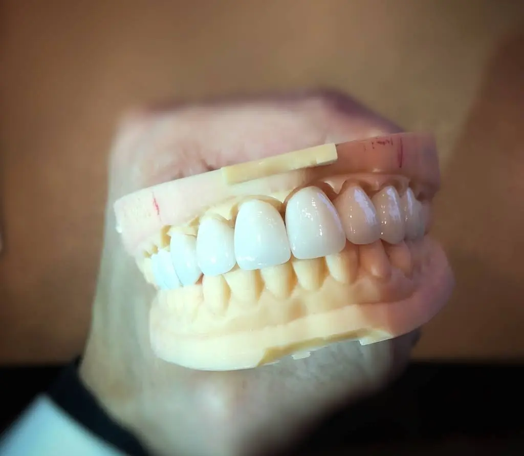 Allure Dental Chicago