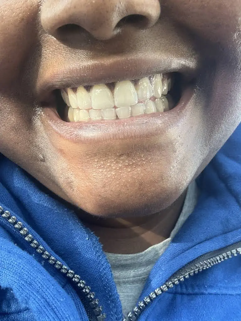 Bright Smile Family Dental Blue Island