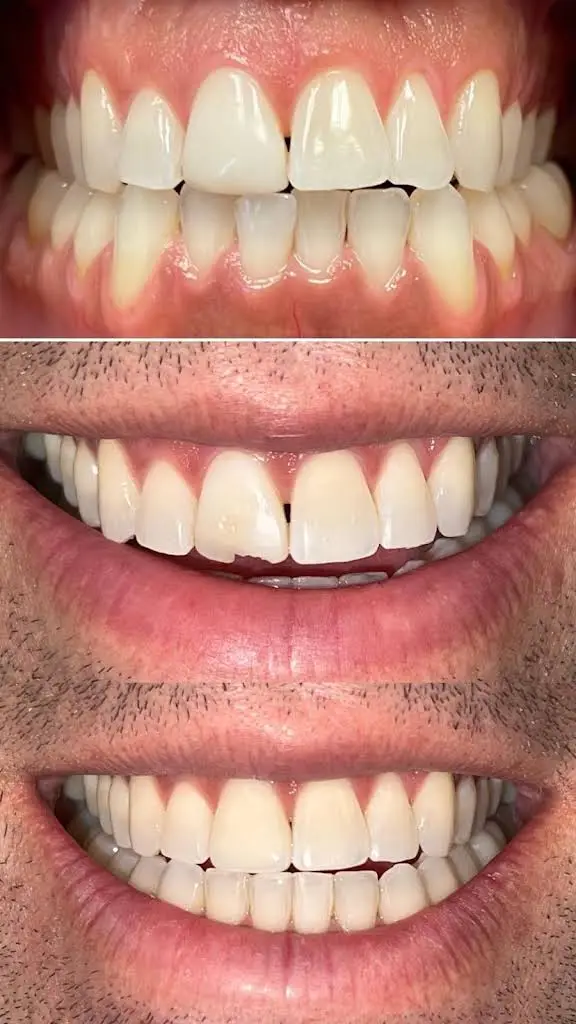 Lifetime Family Dental - Implant and General Dentistry