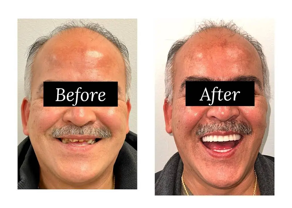 Lifetime Family Dental - Implant and General Dentistry