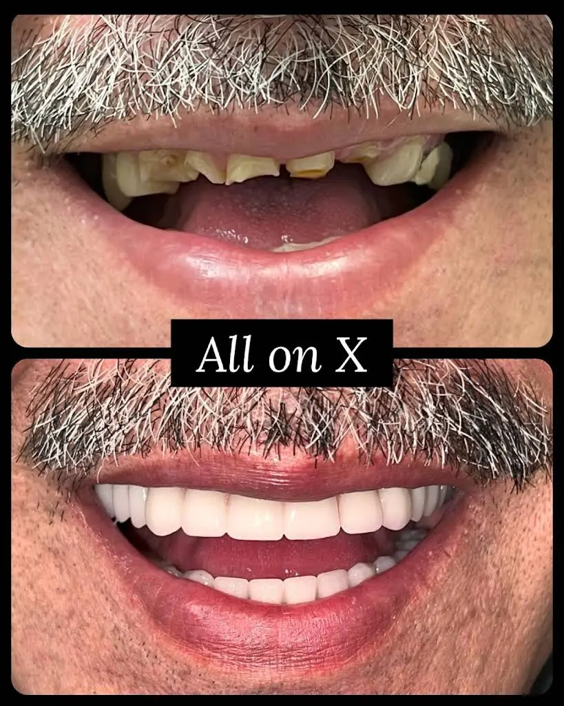 Lifetime Family Dental - Implant and General Dentistry