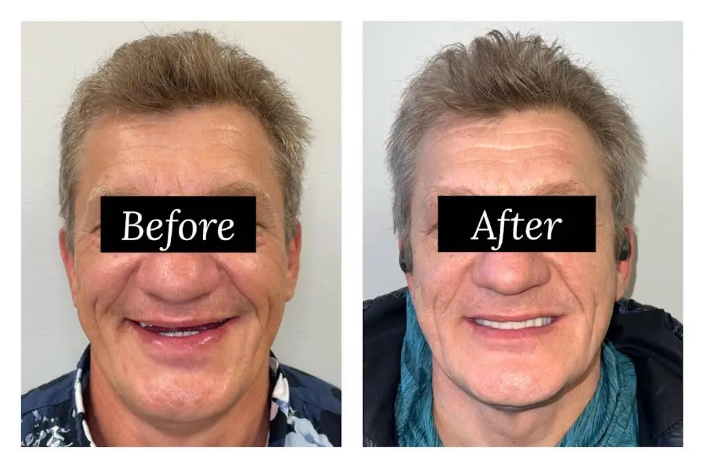 Lifetime Family Dental - Implant and General Dentistry