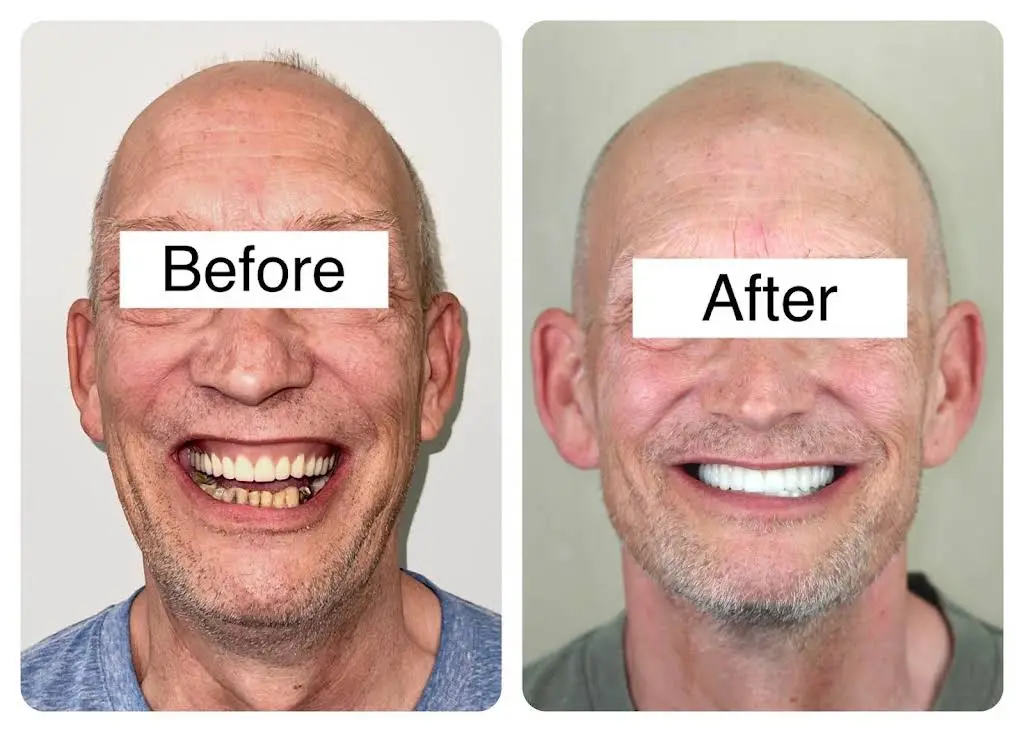 Lifetime Family Dental - Implant and General Dentistry
