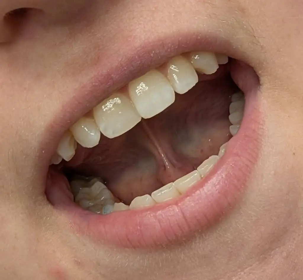 Grove Creek Dental
