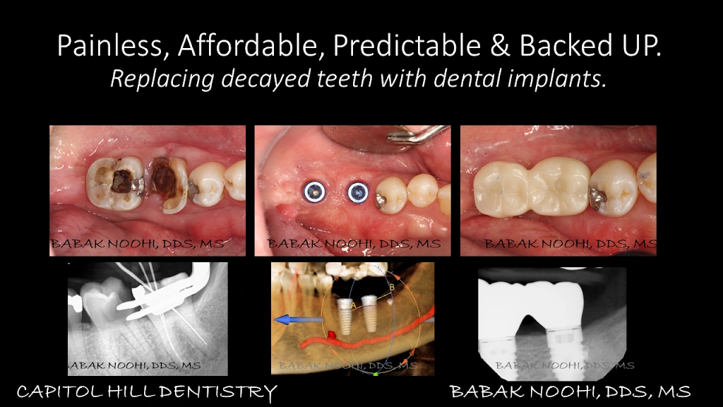 Capitol Hill Dentistry