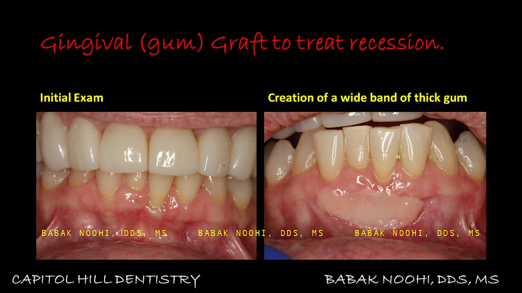 Capitol Hill Dentistry