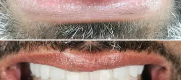 Dental Serenity - Alexandria