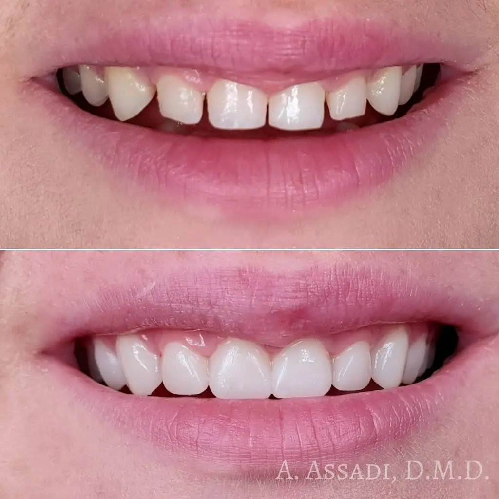Dental Serenity - Alexandria