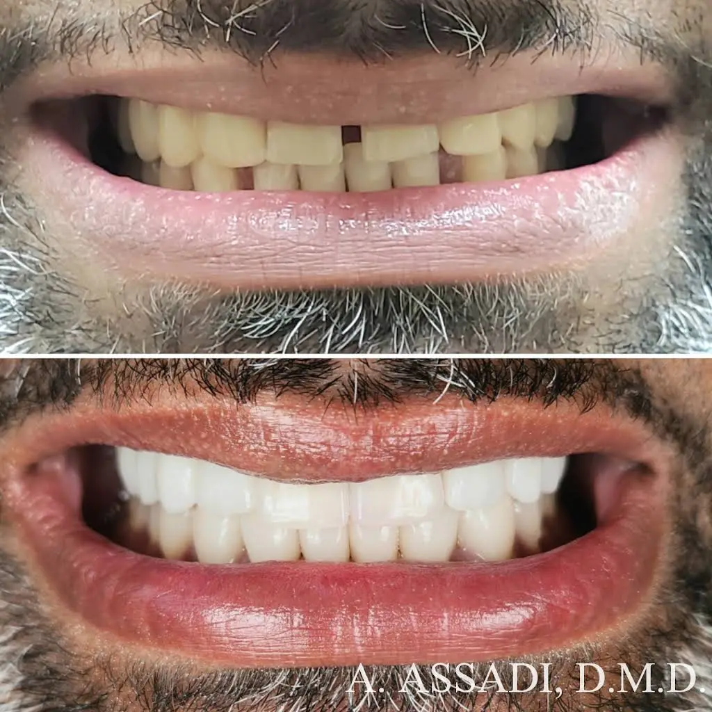 Dental Serenity - Alexandria