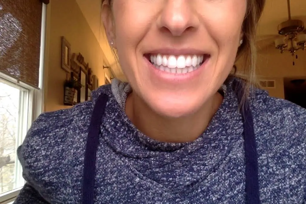 Burkey Orthodontics