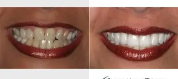 Smile More Today