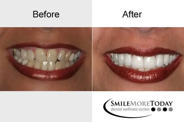 Smile More Today
