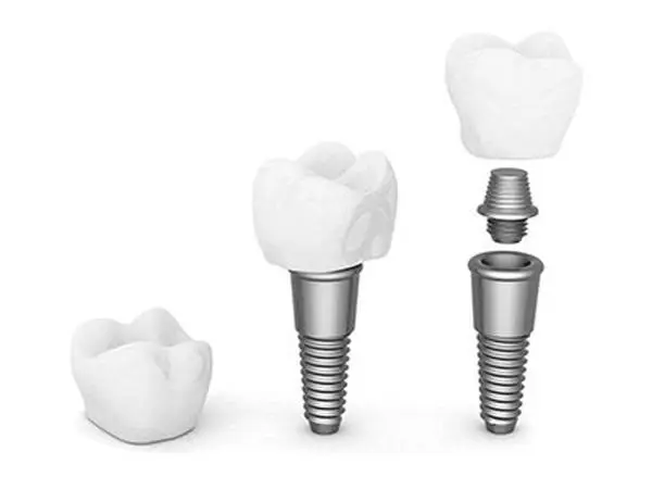Leix Dental