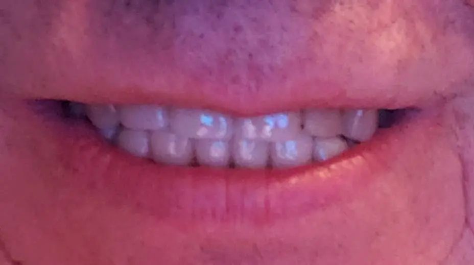 Family Dentistry of Crystal Lake