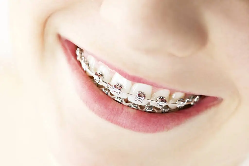 Luce Orthodontics