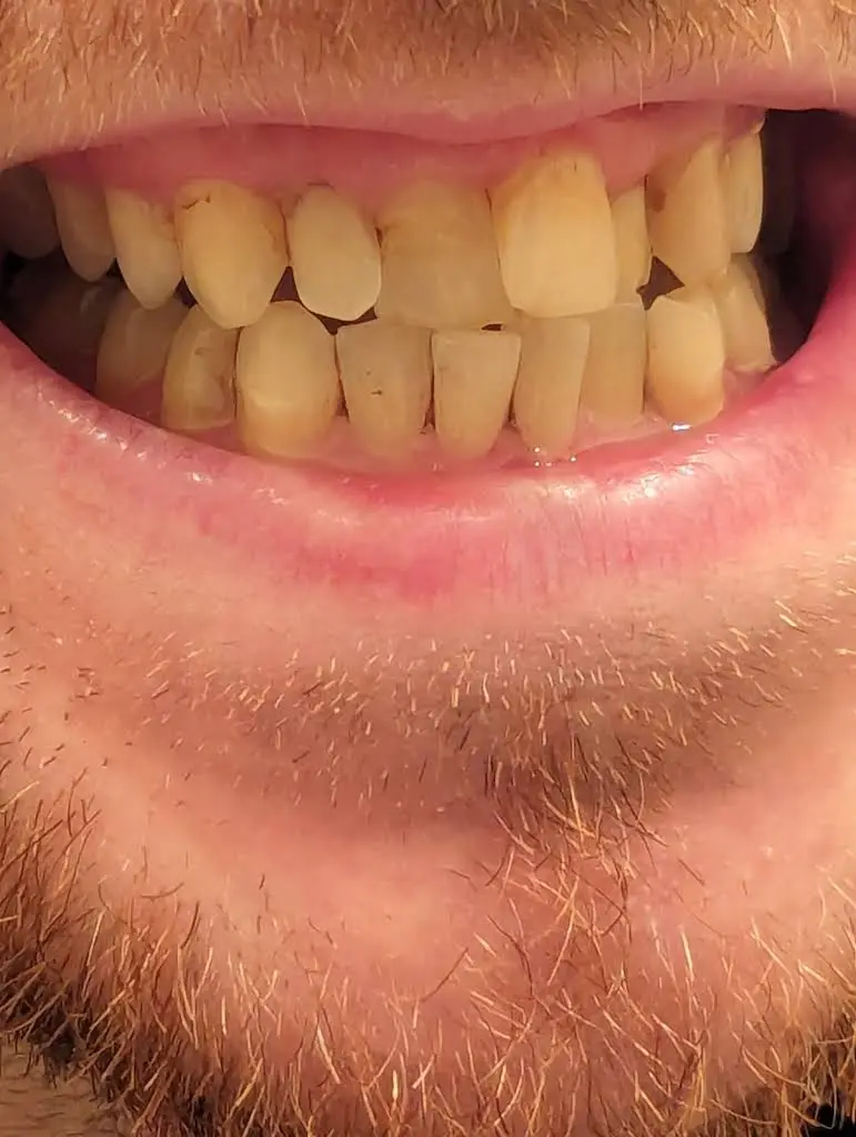 Grayslake Dental Care