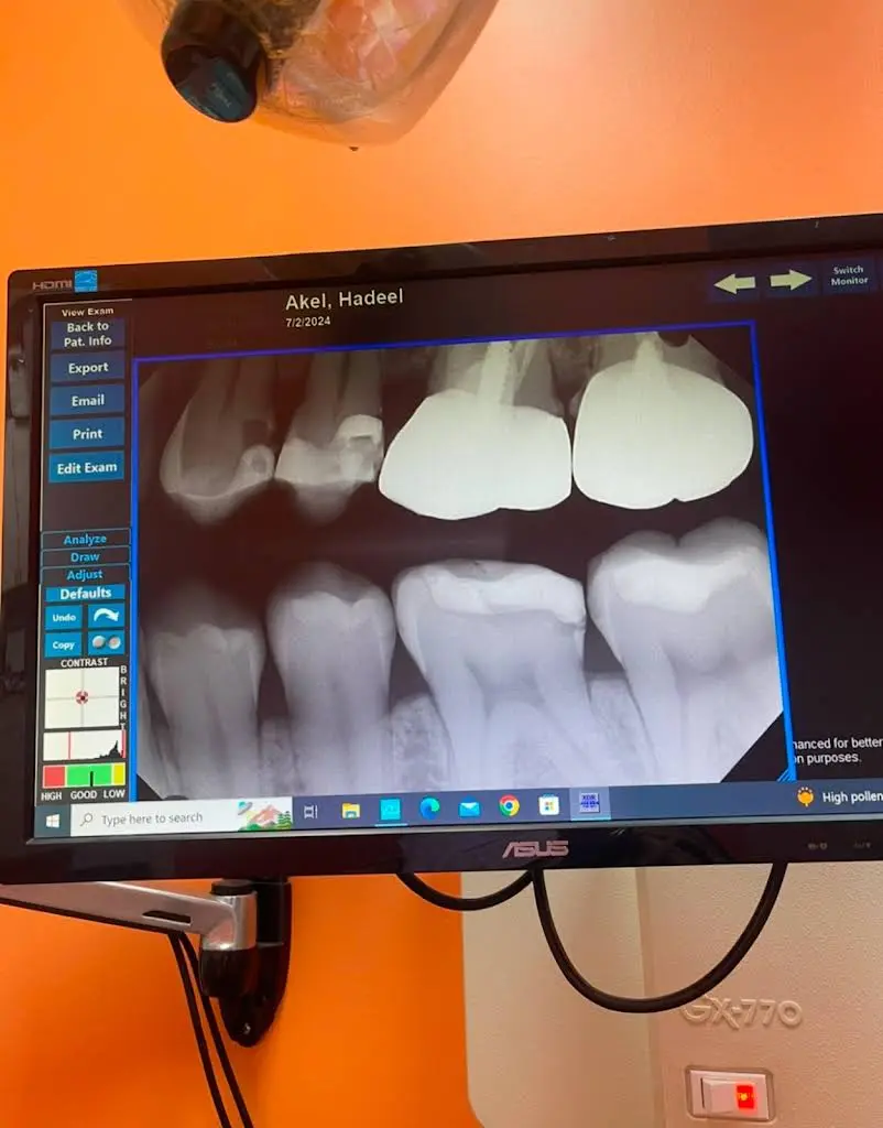 Lincolnway Dental Associates