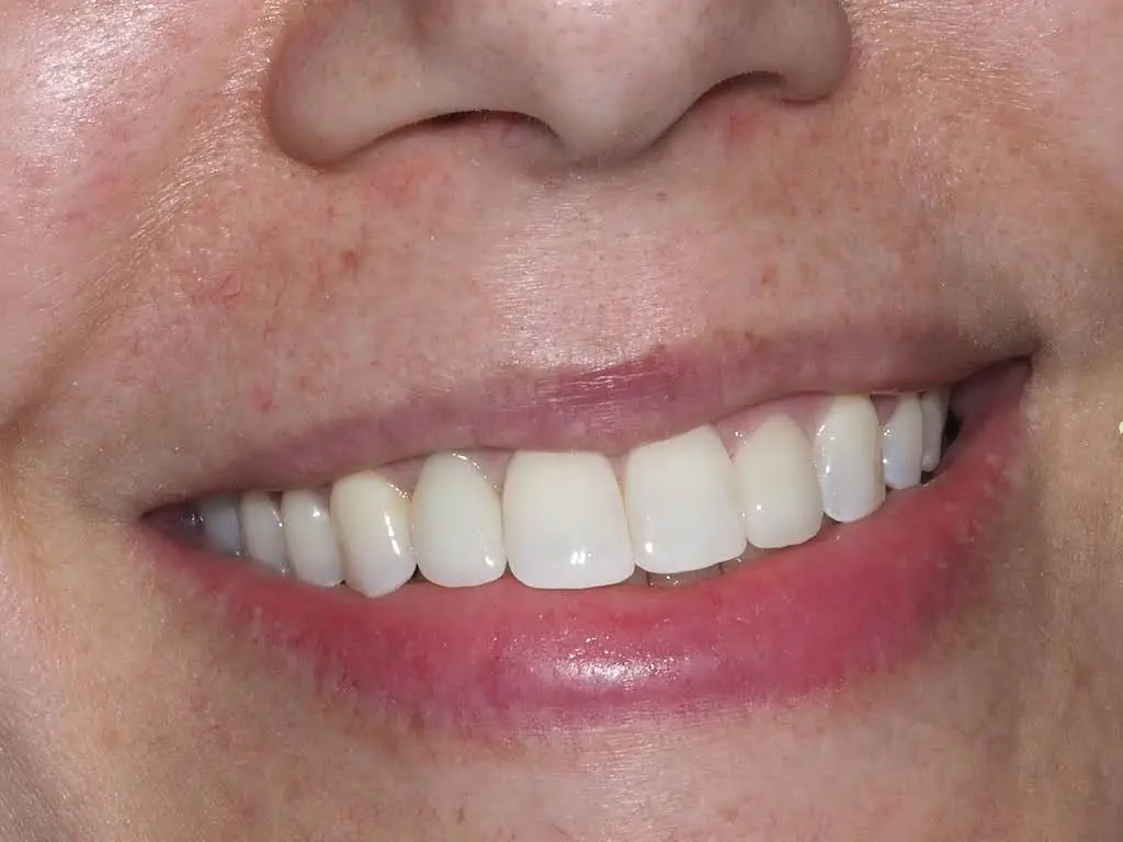 Advance Family Dental Care