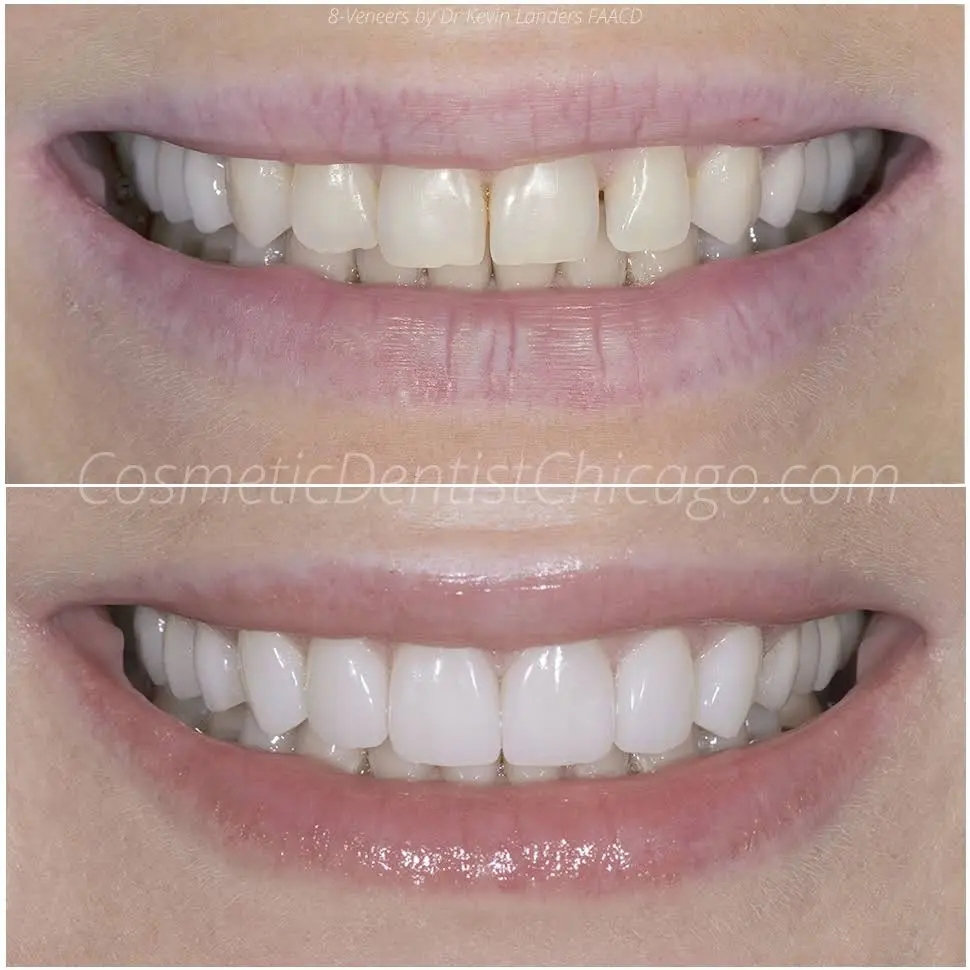 Advanced Cosmetic & Implant Dentistry