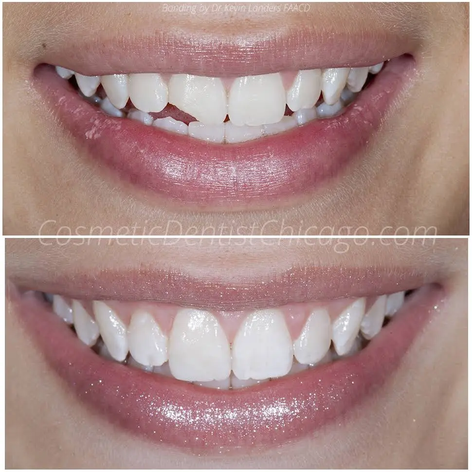 Advanced Cosmetic & Implant Dentistry