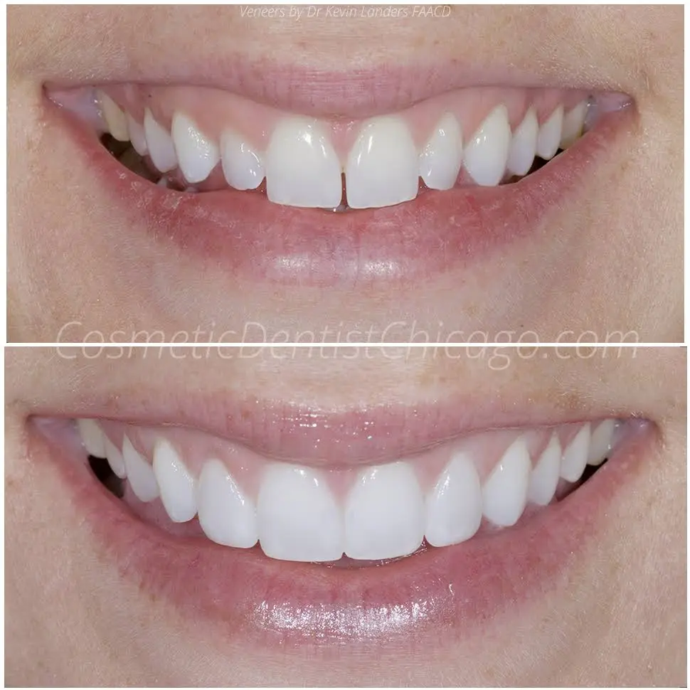 Advanced Cosmetic & Implant Dentistry