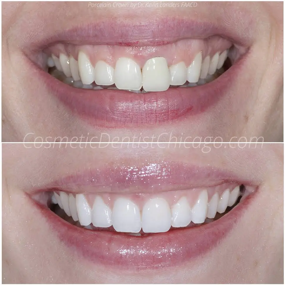Advanced Cosmetic & Implant Dentistry