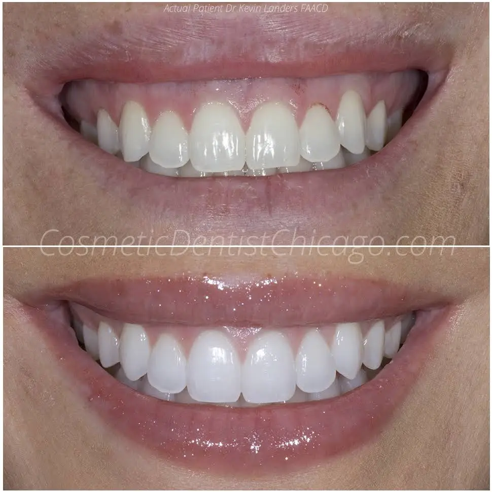 Advanced Cosmetic & Implant Dentistry