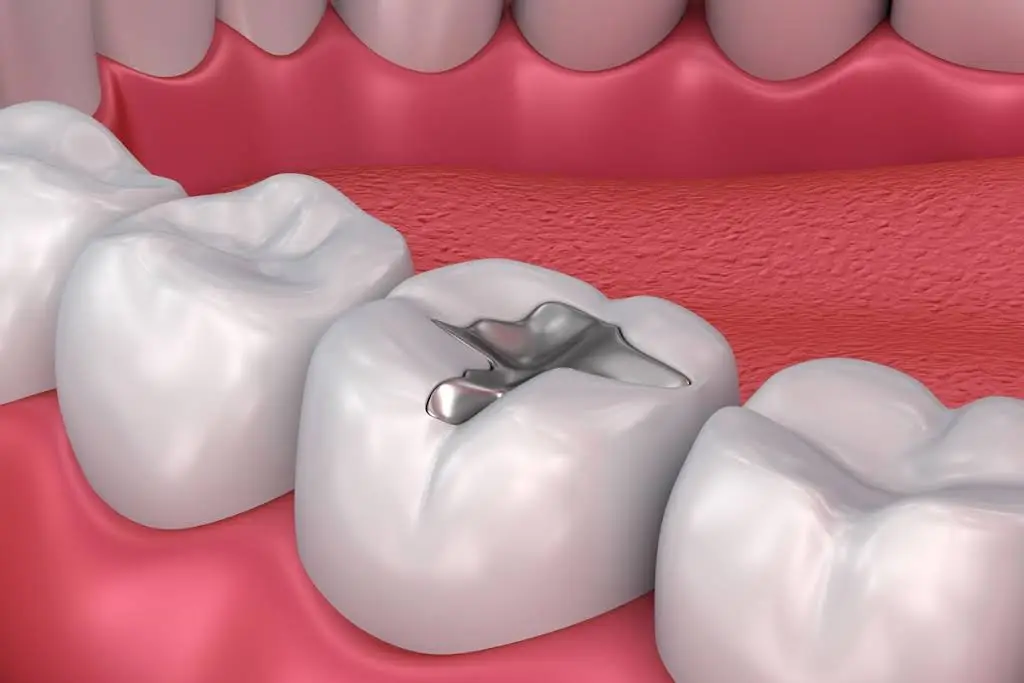 LPS Dental - Downtown Chicago Loop