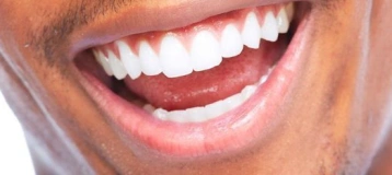 Dental Concepts of Chicago