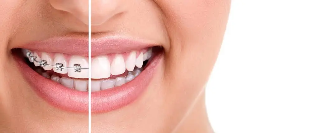 Orland Park Orthodontics