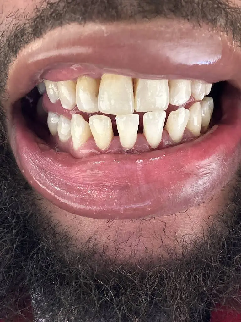 Perfect Smiles