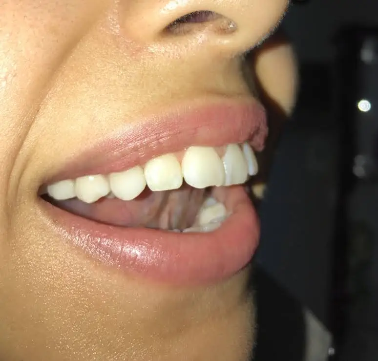 Expert Smiles