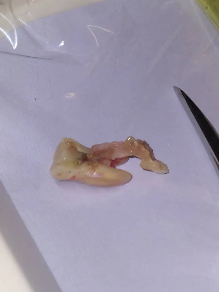 Cedar Hill Dental