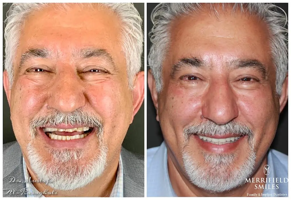 Merrifield Smiles