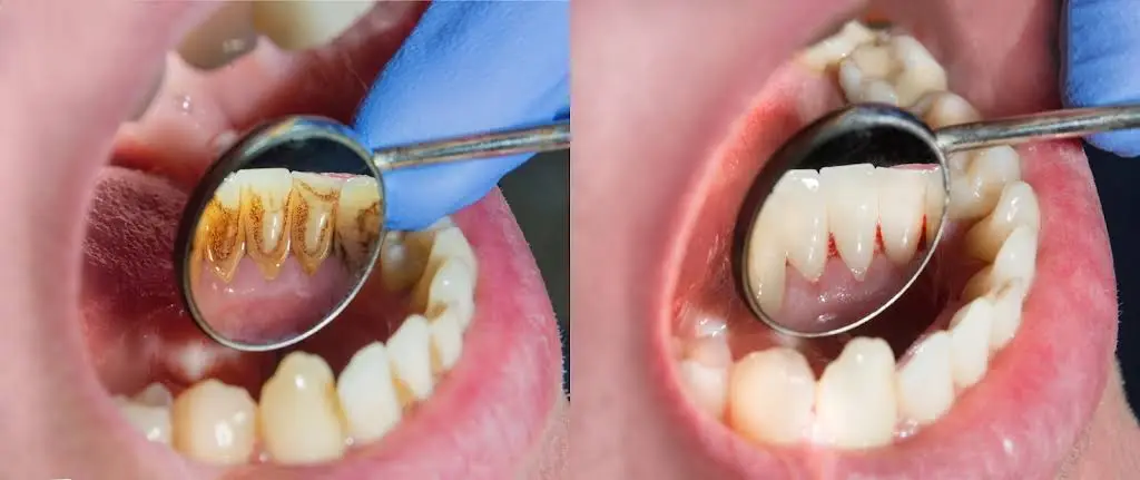 Great Lakes Dental Solutions
