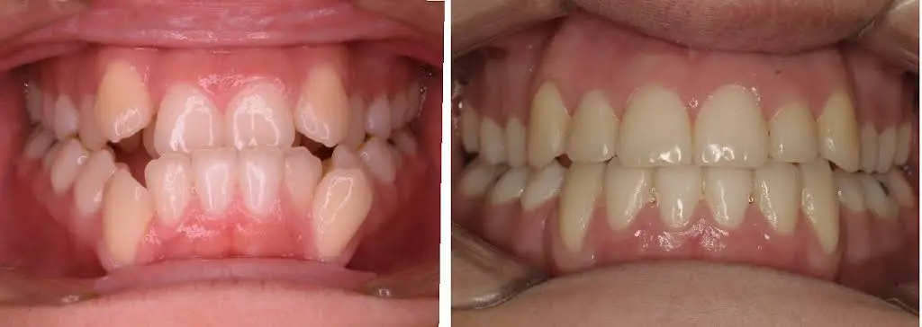 Arpino Orthodontics