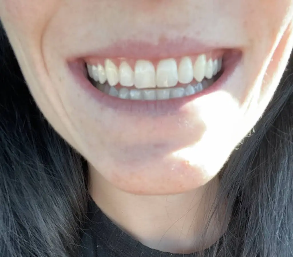 Smiles of Gurnee