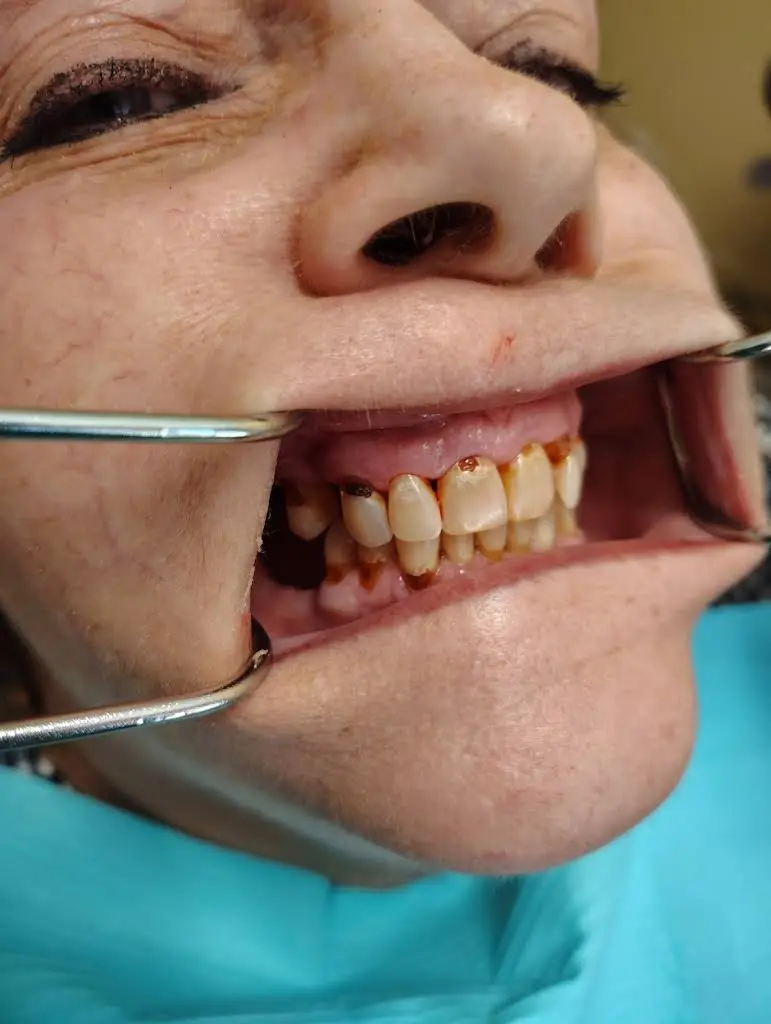 Anderson Dental