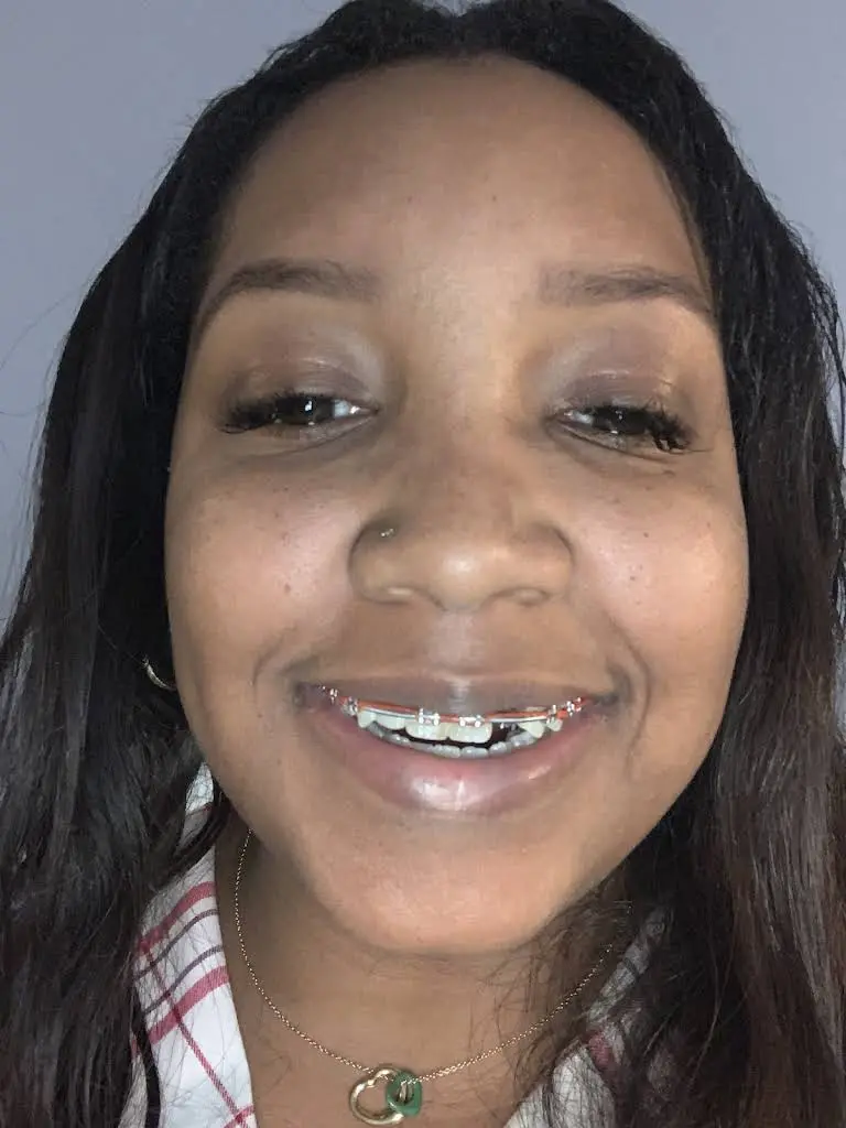Universal Dental of Orland Park