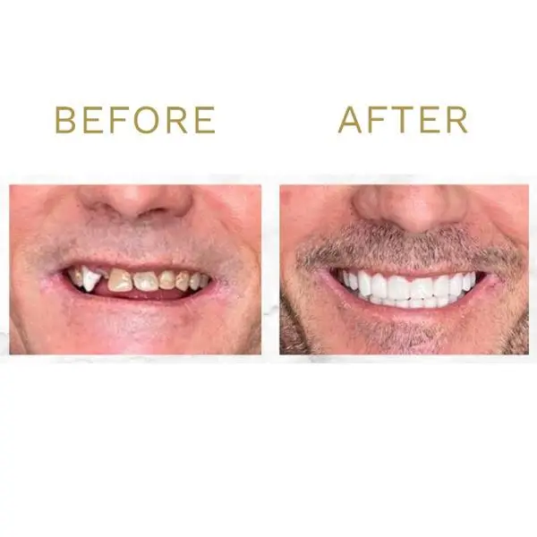 Tinley Park Smiles & Implant Dentistry